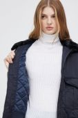 Куртка Pepe Jeans жіноча колір чорний перехідна (2612929) Куртка Pepe Jeans жіноча колір чорний перехідна (2612929)