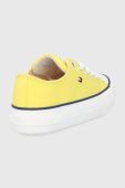 Дитячі кеди Tommy Hilfiger колір жовтий (1999033) Дитячі кеди Tommy Hilfiger колір жовтий (1999033)